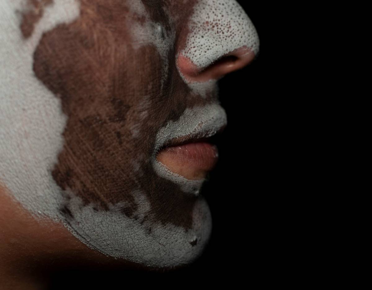 comparison of skin before and after following how to glowing skin steps